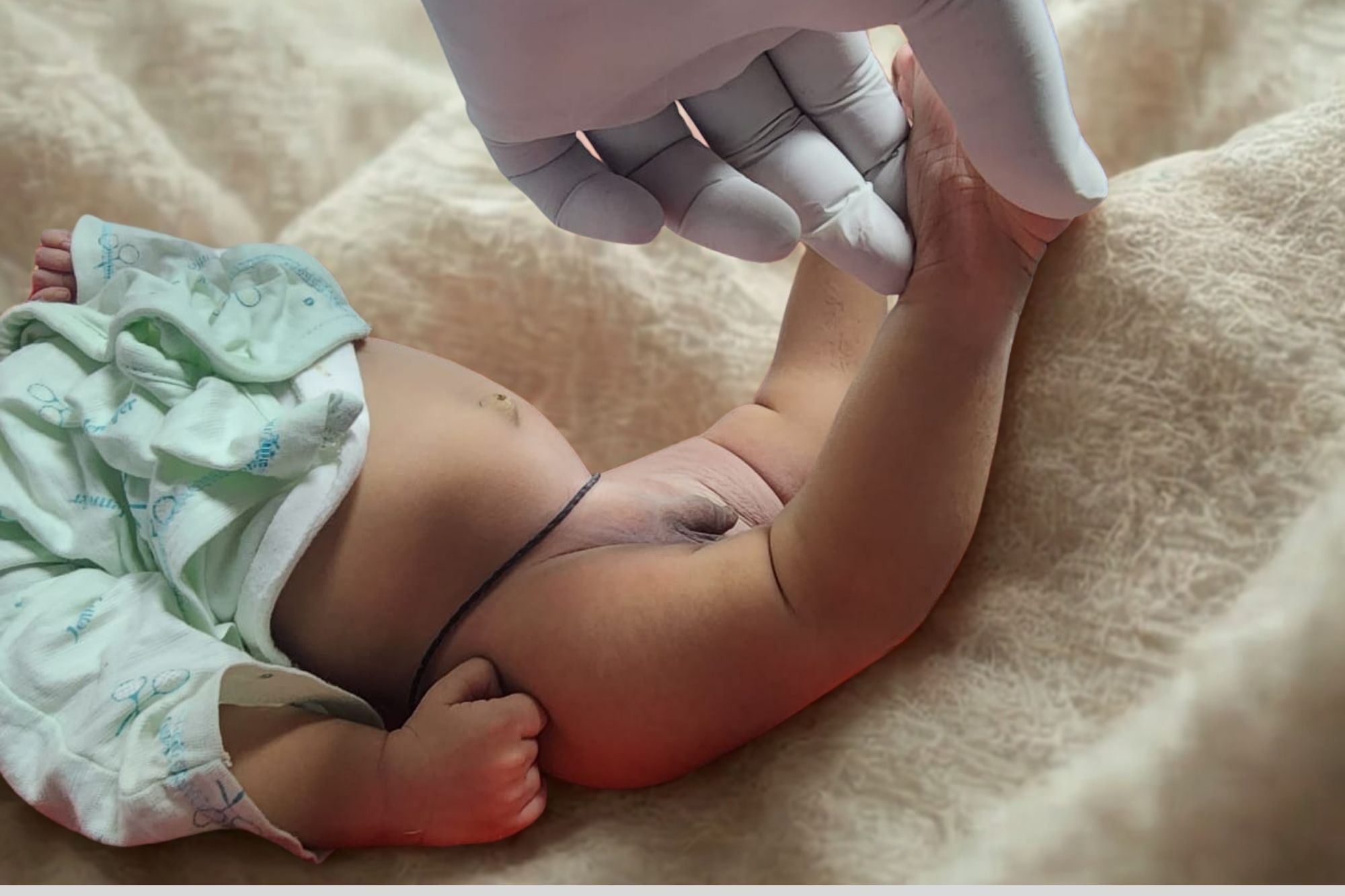 Congenital Dislocation of Knee - Services