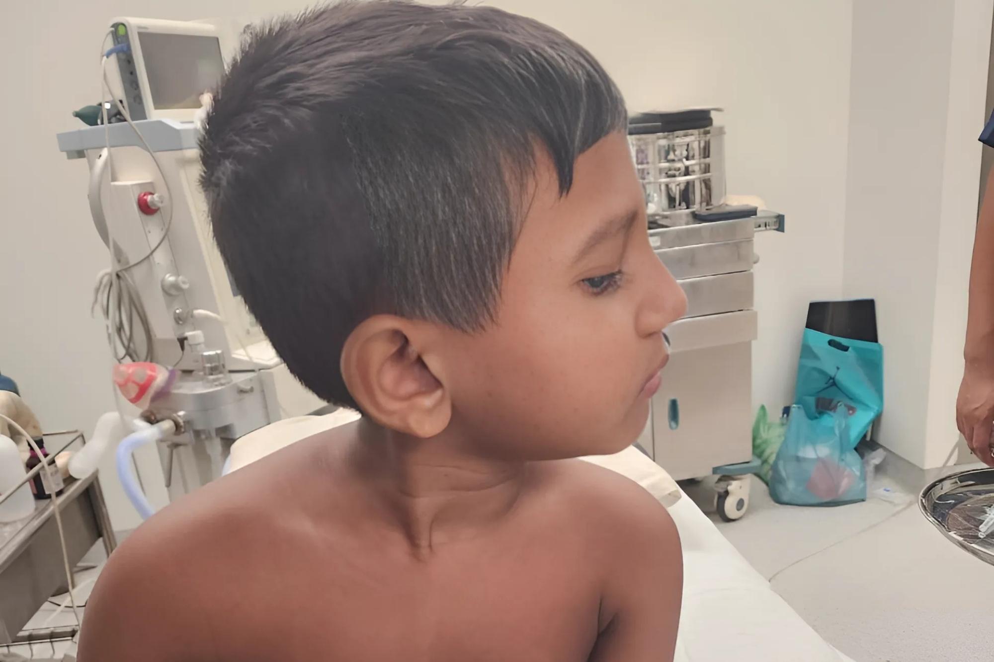 Torticollis - Services